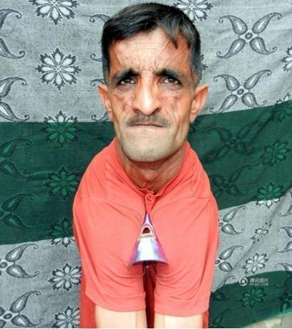 现实版「橡胶人」，身体异常柔软，他的两肩可以随意合并在一起