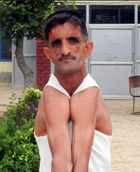 现实版「橡胶人」，身体异常柔软，他的两肩可以随意合并在一起