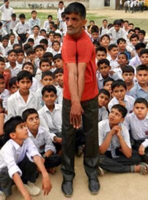 现实版「橡胶人」，身体异常柔软，他的两肩可以随意合并在一起