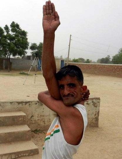 现实版「橡胶人」，身体异常柔软，他的两肩可以随意合并在一起