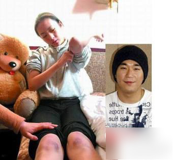 张默打童瑶事件为什么打她 张默打童瑶赔了多少钱两人现状差别大