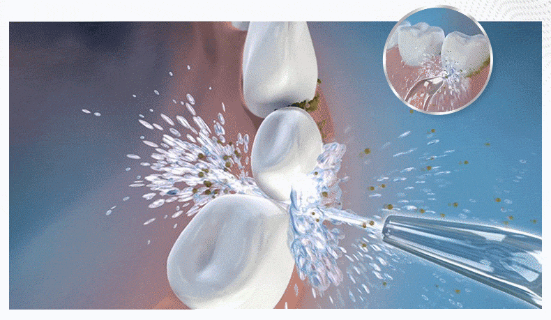 明星为什么不做种植牙(明星有做种植牙的吗)  第6张