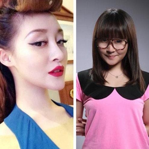 徐海星整容前后，整容(徐海星长什么样)