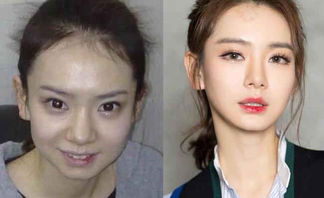 郑爽整容了，郑爽胡彦斌(胡彦斌和郑爽好了多久)