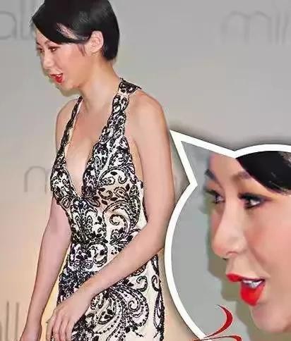 隆胸的明星有哪些（公开承认整形隆胸的十位女明星）