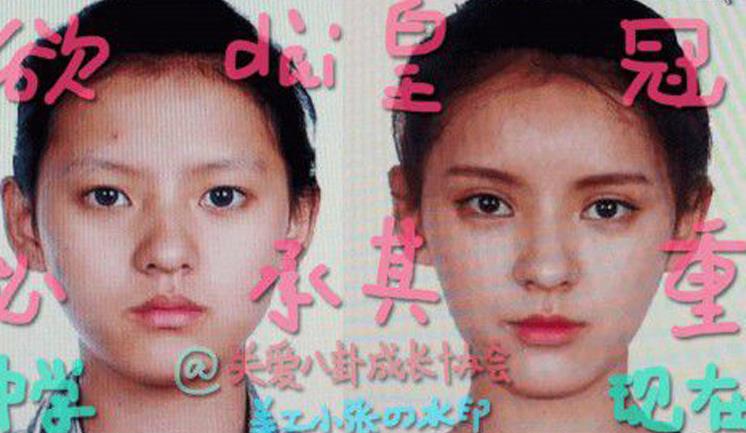 张予曦整容前后对比照曝光 网友直呼张予曦一定动刀了