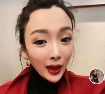 乡爱“香秀”近照大变，脸部僵硬下巴尖，日常戴20万手表镶满钻