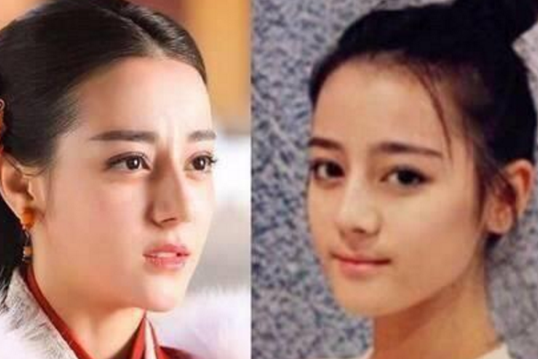 迪丽热巴整容前照片，迪丽热巴整容(热巴整过容前后的图片)