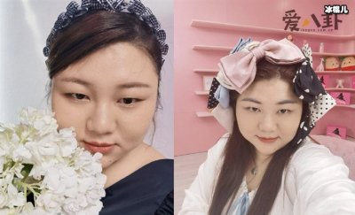 ​杨天真患糖尿病，自曝要切胃是真是假？