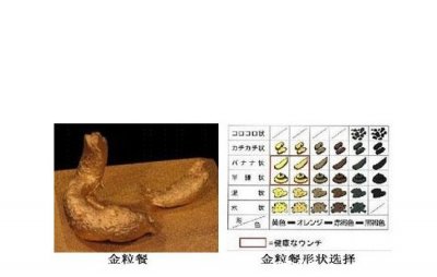 ​日本金粒餐是真的吗，用少女屎为原料制作的食物(是谣言)