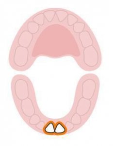 ​宝宝长牙，是该选择磨牙棒还是牙胶呢？