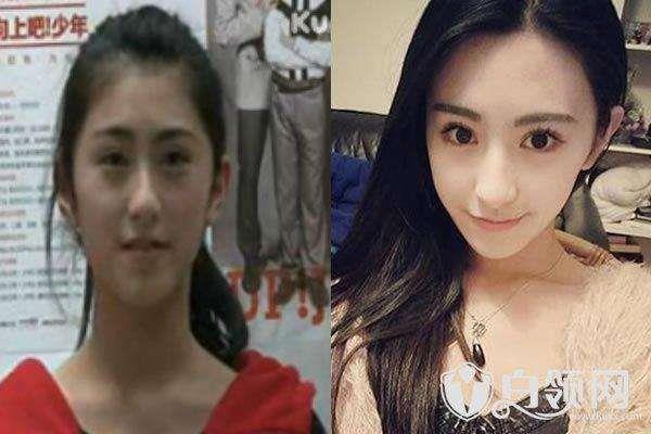 朱圣祎整过容吗 揭秘朱圣祎以前照片被翻差距颇大学生照长这样