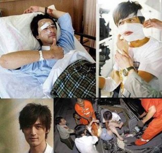 ​胡歌车祸前后照片对比