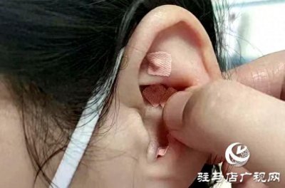 睡眠不好？中医耳穴压豆有妙招