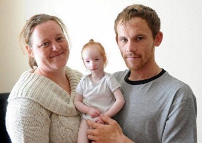 ​外国“瓷娃娃”一出生就被医生判死刑，爸妈却把她养成了小公主