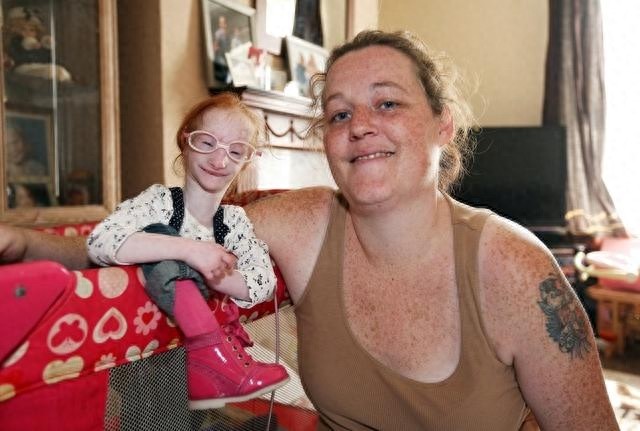 外国“瓷娃娃”一出生就被医生判死刑，爸妈却把她养成了小公主