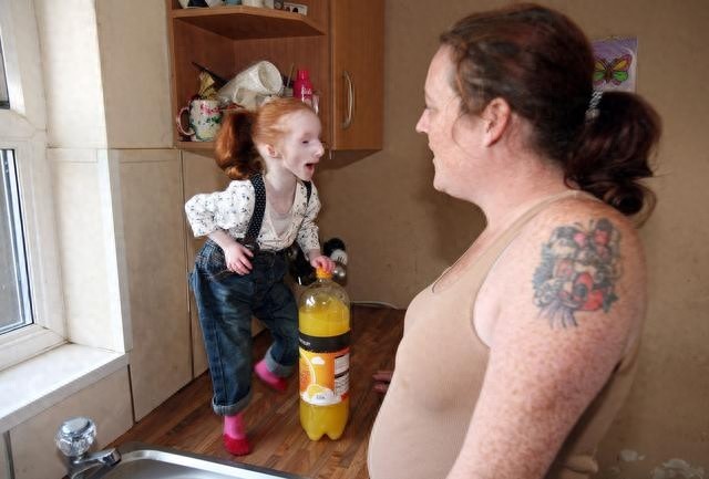 外国“瓷娃娃”一出生就被医生判死刑，爸妈却把她养成了小公主