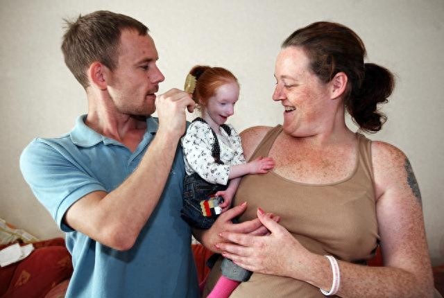 外国“瓷娃娃”一出生就被医生判死刑，爸妈却把她养成了小公主